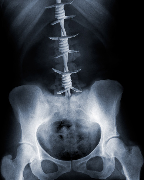 homeSpine